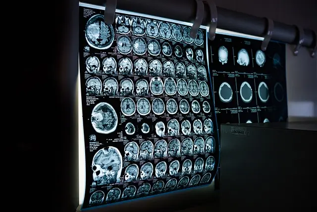 Neurology